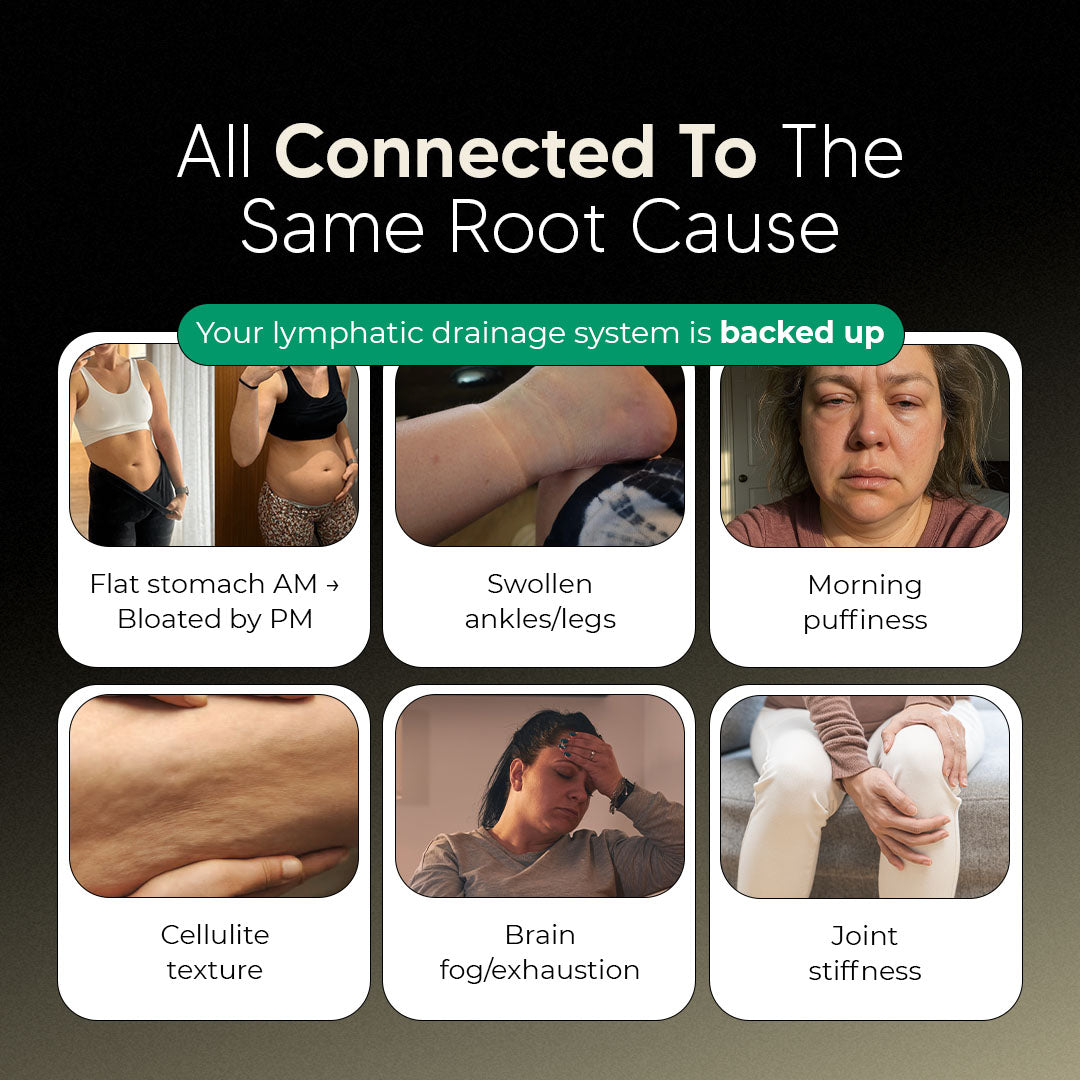 New Maximum Potency Formula - Lymphatic Drainage Capsules by Sculptique™