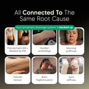 New Maximum Potency Formula - Lymphatic Drainage Capsules by Sculptique™